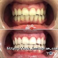 відгуки про Smile Bar фото