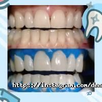 отзывы о Dental City фото
