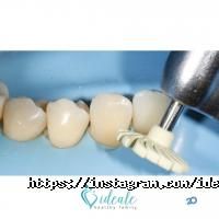 відгуки про Ideale фото