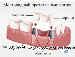 Стоматологии Дента Класс фото