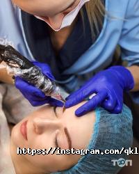 відгуки про Qkla фото