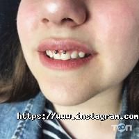 отзывы о VeAn фото