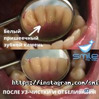 Smile to you відгуки фото