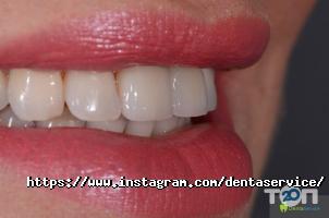 DentaService, стоматологія фото