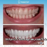 Fdentist відгуки фото