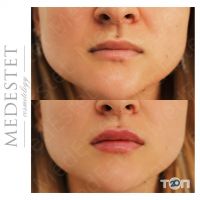 отзывы о МедЭстет фото