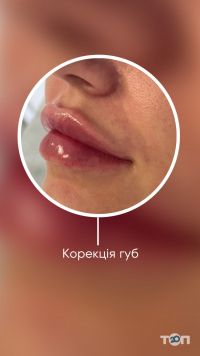 відгуки про Farmoza фото