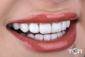 Sweet Teeth, стоматологія - фото 9