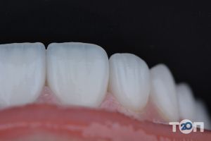 Sweet Teeth, стоматология - фото 10
