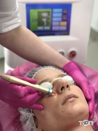 відгуки про Bilyk Ultra Laser фото
