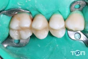 Стоматології Tomchuk Dental Clinic фото