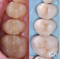 TriODent, стоматологічна клініка - фото 9