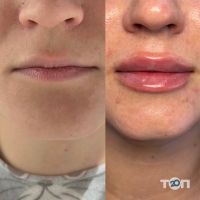 Катя Паламарчук перманентний макіяж Кропивницький відгуки фото