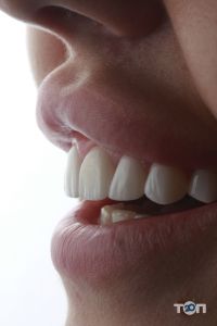 VM Dental Clinic, стоматологія - фото 9