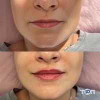 Студія перманентного макіяжу Катерини Паламарчук фото