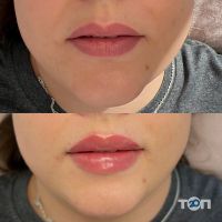 Студія перманентного макіяжу Катерини Паламарчук - фото 9