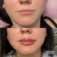 Студія перманентного макіяжу Катерини Паламарчук - фото 10