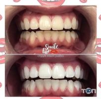 SmileBar, стоматологическая студия фото