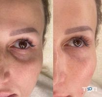 Beauty Line, салон краси - фото 9