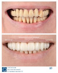 відгуки про КЕС, клініка естетичної стоматології фото