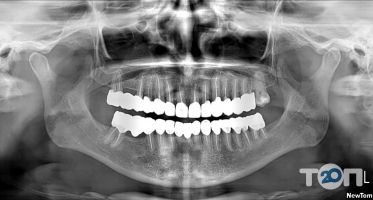 3Диагностика, панорамные снимки и компьютерная томография фото
