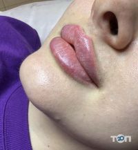 NikLin beauty відгуки фото