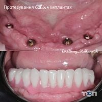Кухаревич Алексей Витальевич, врач-стоматолог - фото 8