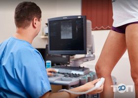 відгуки про AngioLife фото