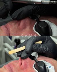 відгуки про KosMet фото