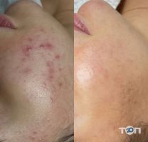 відгуки про Косметолог Бугайчук Юлія фото