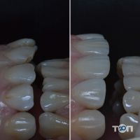 Стоматології Diamond Dental Clinic фото