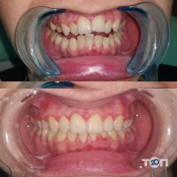 отзывы о O Dent фото