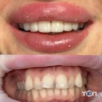 Dental Luxury Clinics відгуки фото