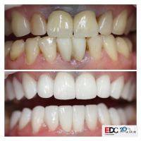 Esthetic Dental Clinic відгуки фото