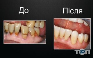 Клініка стоматології Білика відгуки фото