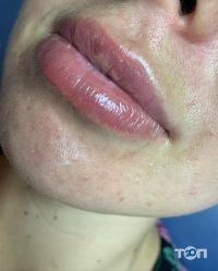 відгуки про Косметолог Тетяна Мірошниченко фото