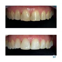 отзывы о Uvn фото