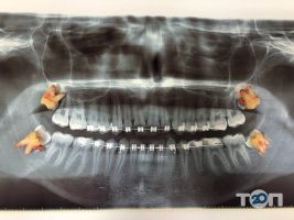 ОСА, стоматологія - фото 8