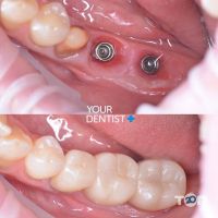 отзывы о Your Dentist+ фото