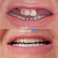 Your Dentist+, стоматология - фото 8