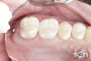 отзывы о IDÉNTI фото