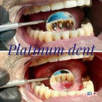 Стоматології Platinum dent фото