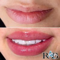 відгуки про R&B фото