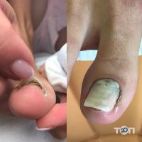 Stoppa Тернопіль відгуки Stoppa Тернопіль відгуки фото