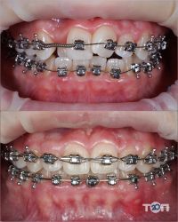 отзывы о Tarasyuk dental clinic фото