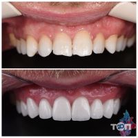 відгуки про Tipster dental clinic фото