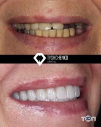 Стоматології Tyshchenko Dental фото