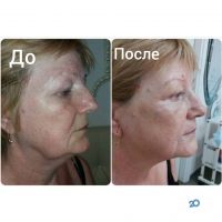 відгуки про УхоженнаяЯ і Красива фото