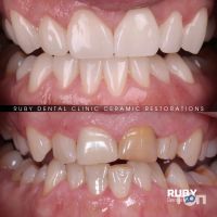 Ruby Dental Clinic Рівне відгуки фото