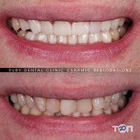 Ruby Dental Clinic, стоматологічна клініка Кухаревича Олексія Віталійовича - фото 9